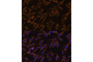 Immunofluorescence analysis of C6 cells using EIF5B antibody (ABIN7267052) at dilution of 1:100. (EIF5B anticorps  (AA 1-273))