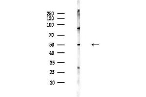 anti-Cholinergic Receptor, Nicotinic, alpha 5 (Neuronal) (CHRNA5) (Internal Region) antibody