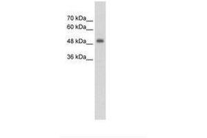 Image no. 1 for anti-CUE Domain Containing 1 (CUEDC1) (AA 251-300) antibody (ABIN203464) (CUEDC1 anticorps  (AA 251-300))