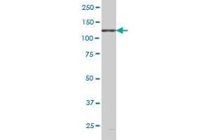 EPHB6 monoclonal antibody (M03), clone 5D8 Western Blot analysis of EPHB6 expression in PC-12 .