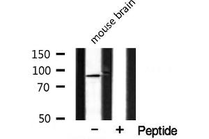 Western blot analysis of extracts from mouse brain, using CAGE1 antibody. (CAGE1 anticorps  (C-Term))