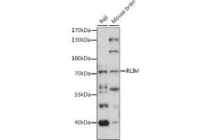 anti-Ring Finger Protein, LIM Domain Interacting (RLIM) (AA 535-624) antibody