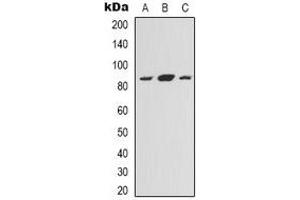 Western blot analysis of NOXIN expression in HEK293T (A), Hela (B), HepG2 (C) whole cell lysates. (C11orf82 anticorps)