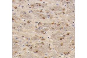 Immunohistochemistry analysis of paraffin-embedded mouse hippocampus using VMAT2 (ABIN7075655) at dilution of 1: 1600
