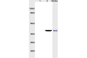 Lane 1: rat heart lysates Lane 2: rat brain lysates probed with Anti LTB4-R2 Polyclonal Antibody, Unconjugated (ABIN748643) at 1:200 in 4 °C. (LTB4R2 anticorps  (AA 25-120))