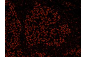 Immunofluorescence (IF) image for anti-Histone Deacetylase 2 (HDAC2) (C-Term) antibody (ABIN7448973) (HDAC2 anticorps  (C-Term))