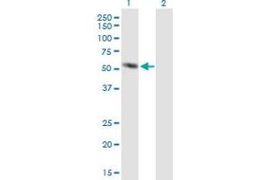 Western Blot analysis of AMY2A expression in transfected 293T cell line by AMY2A MaxPab polyclonal antibody.