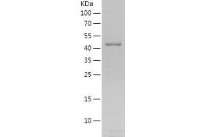 Western Blotting (WB) image for Prospero Homeobox 1 (PROX1) (AA 354-737) protein (His tag) (ABIN7124604)