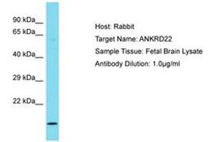 Image no. 1 for anti-Ankyrin Repeat Domain 22 (ANKRD22) (AA 48-97) antibody (ABIN6750744) (ANKRD22 anticorps  (AA 48-97))