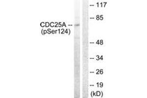 Western blot analysis of extracts from 293 cells treated with UV 15', using CDC25A (Phospho-Ser124) Antibody.