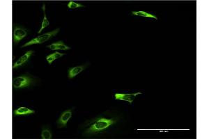 Immunofluorescence of monoclonal antibody to KHK on HeLa cell. (Ketohexokinase anticorps  (AA 1-298))
