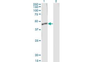 Western Blot analysis of SERPINB1 expression in transfected 293T cell line by SERPINB1 monoclonal antibody (M01), clone 4A7.