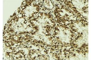 ABIN6279800 at 1/100 staining Human lung tissue by IHC-P. (SRPK2 anticorps)