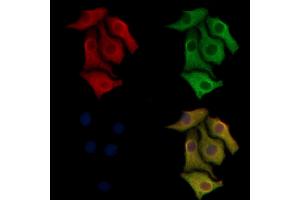 ABIN6260641 and ABIN6268823 staining Hela cells by IF/ICC. (CD69 anticorps  (Internal Region))