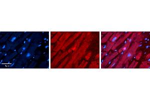 Rabbit Anti-TSG101 Antibody   Formalin Fixed Paraffin Embedded Tissue: Human heart Tissue Observed Staining: Cytoplasmic, nucleus Primary Antibody Concentration: 1:100 Other Working Concentrations: N/A Secondary Antibody: Donkey anti-Rabbit-Cy3 Secondary Antibody Concentration: 1:200 Magnification: 20X Exposure Time: 0. (TSG101 anticorps  (N-Term))