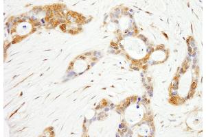anti-Odd-Skipped Related 1 (OSR1) (AA 325-375) antibody