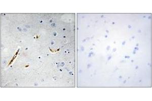 Immunohistochemistry (IHC) image for anti-Transcription Factor 3 (E2A Immunoglobulin Enhancer Binding Factors E12/E47) (TCF3) (AA 571-620) antibody (ABIN2889399) (TCF3 anticorps  (AA 571-620))