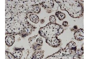Image no. 1 for anti-Diacylglycerol Kinase, alpha 80kDa (DGKA) (AA 1-736) antibody (ABIN599366) (DGKA anticorps  (AA 1-736))