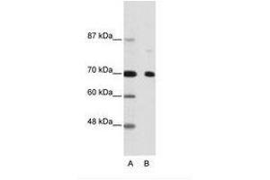 Image no. 1 for anti-Nuclear Receptor Co-Repressor 2 (NCOR2) (AA 541-590) antibody (ABIN202991) (NCOR2 anticorps  (AA 541-590))