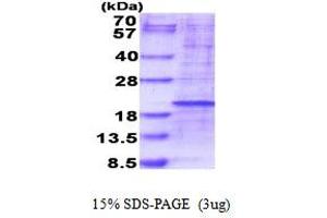 SDS-PAGE (SDS) image for Ribosomal Protein L35 (RPL35) (AA 1-123) protein (His tag) (ABIN6387489)