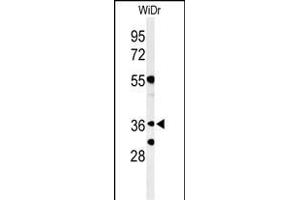 Western blot analysis of NSE4A Antibody (N-term) (ABIN653864 and ABIN2843120) in WiDr cell line lysates (35 μg/lane). (NSMCE4A anticorps  (N-Term))