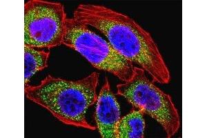 Fluorescent confocal image of U251 cell stained with NFATC4 antibody.