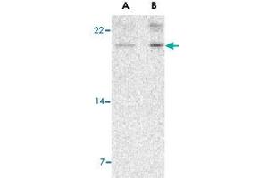 Western blot analysis of AES in 293 cell lysate with AES polyclonal antibody  at (A) 2 and (B) 4 ug/mL . (AES anticorps  (N-Term))