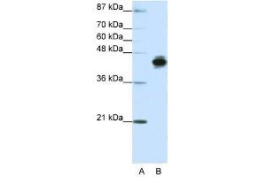 Cytokeratin 18 antibody used at 1. (Cytokeratin 18 anticorps  (N-Term))