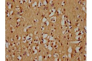 IHC image of ABIN7176072 diluted at 1:300 and staining in paraffin-embedded human brain tissue performed on a Leica BondTM system. (ZIM2 anticorps  (AA 1-124))