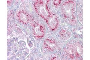 Anti-P2RX2 / P2X2 antibody IHC of human kidney.