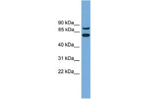 WB Suggested Anti-YY1AP1  Antibody Titration: 0.