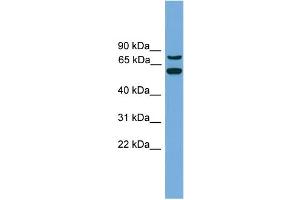 WB Suggested Anti-YY1AP1  Antibody Titration: 0. (YY1AP1 anticorps  (Middle Region))