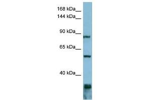 WB Suggested Anti-EPS8 Antibody Titration: 0. (EPS8 anticorps  (Middle Region))