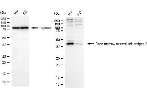Western blotting analysis using bone marrow stromal cell antigen 2 antibody (ABIN7797773). (Recombinant BST2 anticorps)