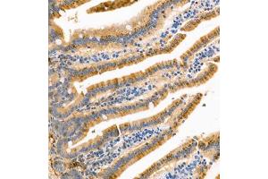 Immunohistochemistry of paraffin embedded mouse small intestine using APOA4 (ABIN7073084) at dilution of 1:1200 (300x lens)