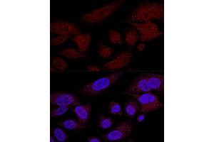 Confocal immunofluorescence analysis of U2OS cells using TAZ antibody (ABIN6130800, ABIN6150278, ABIN6150279 and ABIN6224227) at dilution of 1:100 (60x lens).