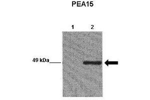 WB Suggested Anti-PEA15 Antibody  Positive Control: Lane 1:241 µg EGFP-transfected MCF7 lysate Lane 2: 041 µg EGFP-PEA15 transfected MCF7 lysate Primary Antibody Dilution: 1:0000Secondary Antibody: Goat anti-rabbit-HRP Secondry  Antibody Dilution: 1:0000Submitted by: Yann Wallez (Sanford-Burnham Medical Research Institute)
