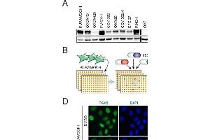 Class I ,but not class II, HDAC inhibitors reduced PAX8 expression.