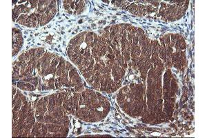 Image no. 5 for anti-Dynamin 1-Like (DNM1L) antibody (ABIN1497870)