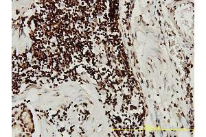 Immunoperoxidase of monoclonal antibody to SGK on formalin-fixed paraffin-embedded human stomach tissue. (SGK1 anticorps  (AA 1-431))