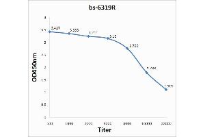 Lane 1: mouse brain lysates Lane 2: mouse intestine lysates probed with Anti IL-1 BETA/IL-1B Polyclonal Antibody, Unconjugated (ABIN872644) at 1:200 in 4 °C.