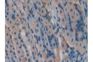 Detection of GREM1 in Mouse Stomach Tissue using Polyclonal Antibody to Gremlin 1 (GREM1)