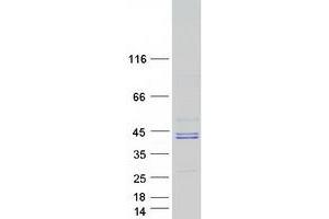 Validation with Western Blot (HLA B7 Protein (Myc-DYKDDDDK Tag))