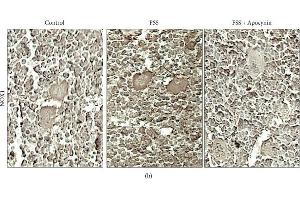 Apocynin prevents oxidative stress in megakaryocytes of stressed mice.