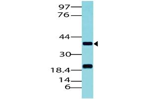 Image no. 1 for anti-Paired Box 5 (PAX5) (AA 102-339) antibody (ABIN5027430) (PAX5 anticorps  (AA 102-339))