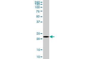 HEMK2 MaxPab polyclonal antibody. (N6AMT1 anticorps  (AA 1-186))