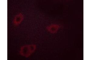 ABIN6267338 staining HeLa cells treated with TNF-a 20nM 15' by ICC/IF.