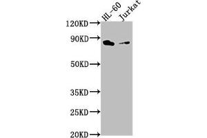 Western Blot Positive WB detected in: HL-60 whole cell lysate, Jurkat whole cell lysate All lanes: ELMO1 antibody at 1:2000 Secondary Goat polyclonal to rabbit IgG at 1/50000 dilution Predicted band size: 84, 29, 50 kDa Observed band size: 84 kDa (ELMO1 anticorps  (AA 520-727))