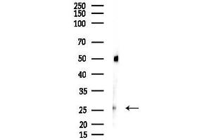 Western blot analysis of lysates from Rat lung, using MOSP Antibody at 1/1000 dilution.