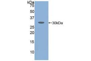 Western blot analysis of recombinant Human ATXN1. (Ataxin 1 anticorps  (AA 569-807))